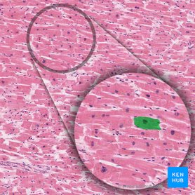 Cardiac muscle cell (Cardiomyocytus); Image: 