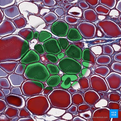 Folliculus thyroidea (Schilddrüsenfollikel); Bild: 