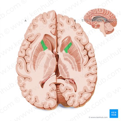 Anterior limb of internal capsule (Crus anterius capsulae internae); Image: Paul Kim