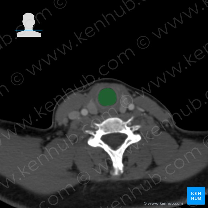 Trachée (Trachea); Image : 