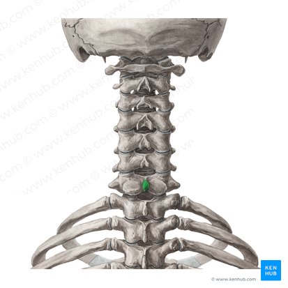 Processus spinosus vertebrae C7 (Dornfortsatz des Wirbels C7); Bild: Yousun Koh