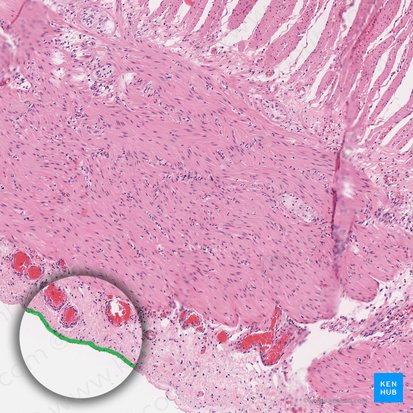 Mesothelium of visceral peritoneum (Mesothelium peritonei visceralis); Image: 
