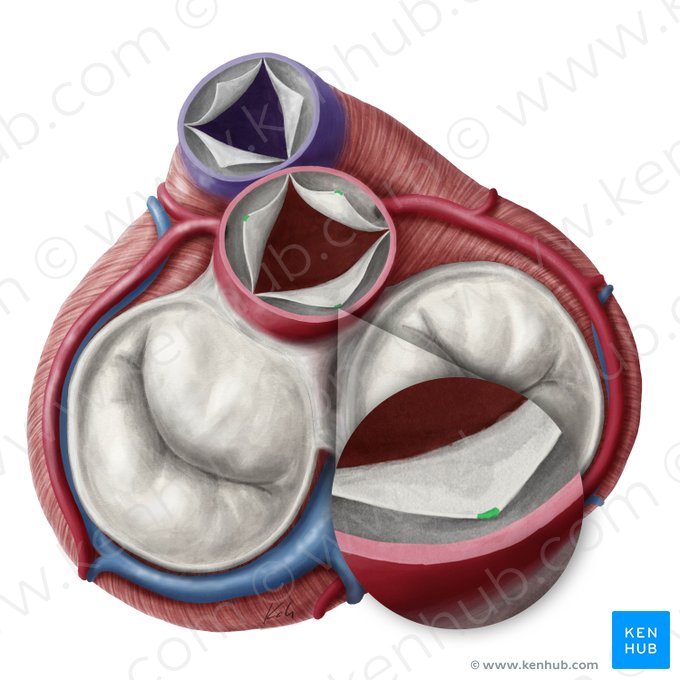 Nódulos de las válvulas semilunares de la valva aórtica (Noduli valvularum semilunarium valvae aortae); Imagen: Yousun Koh