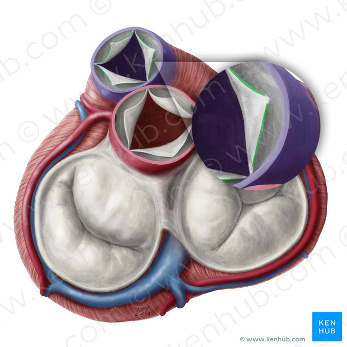 Lúnulas de las válvulas semilunares de la valva pulmonar (Lunulae valvularum semilunarium valvae trunci pulmonalis); Imagen: Yousun Koh