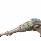Talonavicular joint