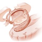Comisura anterior