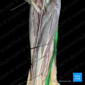 Musculus flexor carpi ulnaris (Ellenseitiger Handbeuger); Bild: 