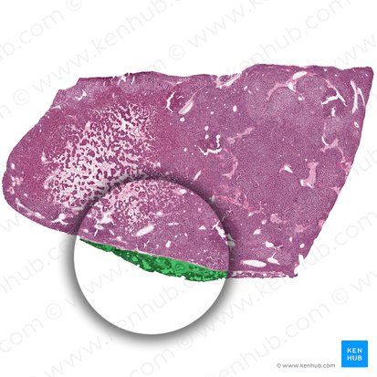 Lobule of parathyroid gland (Lobulus glandulae parathyroidae); Image: 