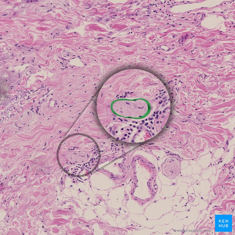 Capsule of Pacinian corpuscle - histological slide
