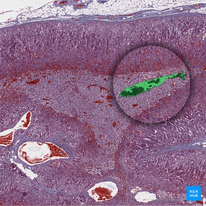 Vena centralis medullaris (Zentralvene des Nebennierenmarks); Bild: 