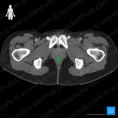Canal anal (Canalis analis); Imagem: 