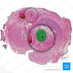 Arteria dorsalis penis (Rückenarterie des Penis); Bild: 