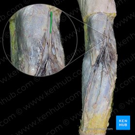 Medial antebrachial cutaneous nerve (Nervus cutaneus medialis antebrachii); Image: 