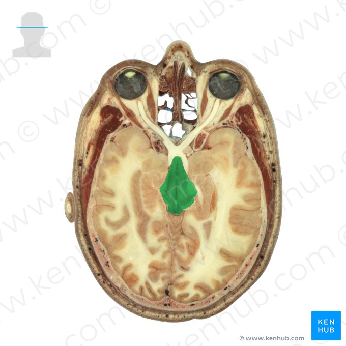 Midbrain (Mesencephalon); Image: National Library of Medicine