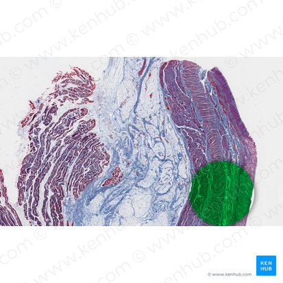 Cardia of stomach (Cardia gastris); Image: 