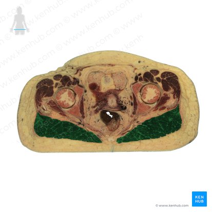 Musculus gluteus maximus (Großer Gesäßmuskel); Bild: National Library of Medicine