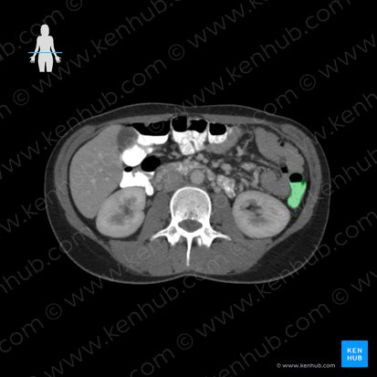 Descending colon (Colon descendens); Image: 