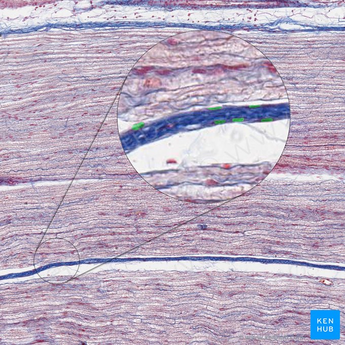 Perineurial cell (Perineuriocytus); Image: 