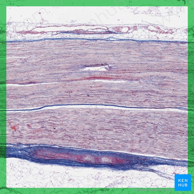 Longitudinal section of peripheral nerve; Image: 