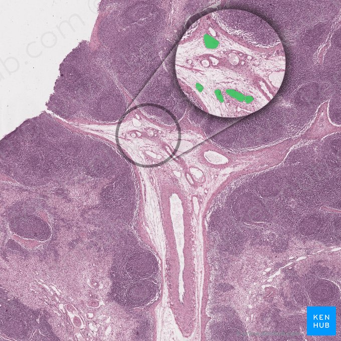 Vasos linfáticos eferentes (Vas lymphaticum efferens); Imagem: 