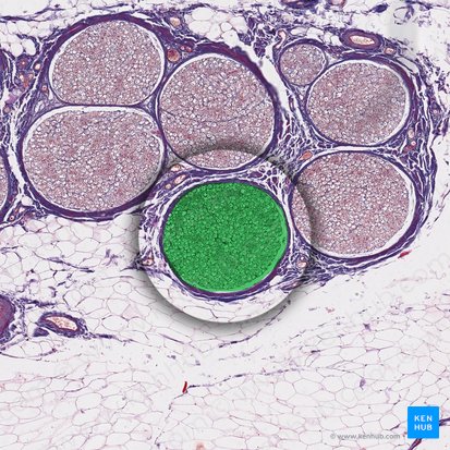 Nerve fascicle (Fasciculus nervi); Image: 