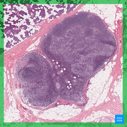 Nodus lymphoideus nonreactivus (Normaler Lymphknoten); Bild: 