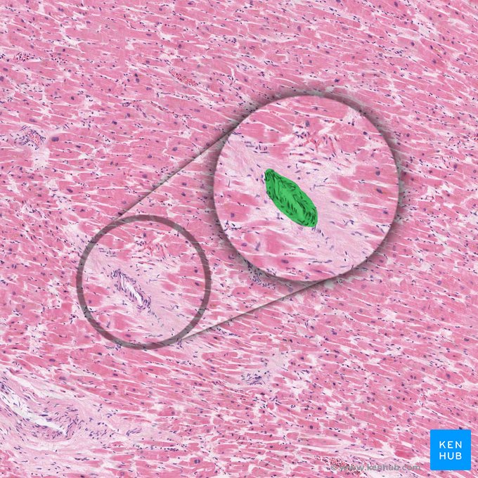 Arteriola intramuscular (Arteriola intramuscularis); Imagen: 