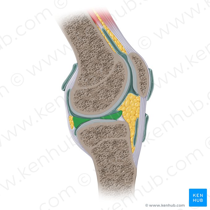 Lateral meniscus (Meniscus lateralis); Image: Paul Kim