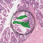 Differentialdiagnose - Magen-Darm-Trakt