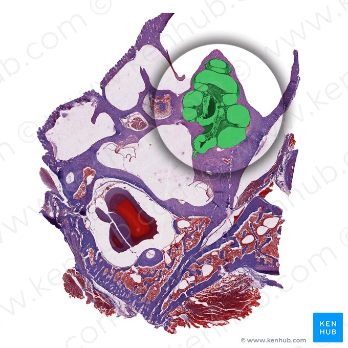 Cóclea (Cochlea); Imagen: 