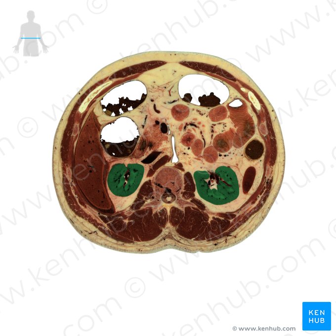 Kidney (Ren); Image: National Library of Medicine