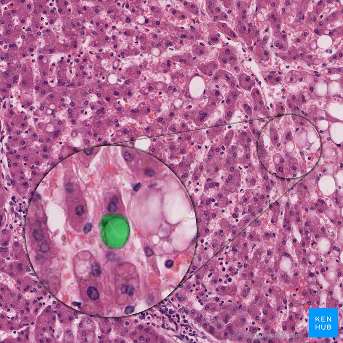 Hepatic stellate cell (Cellula perisinusoidalis); Image: 