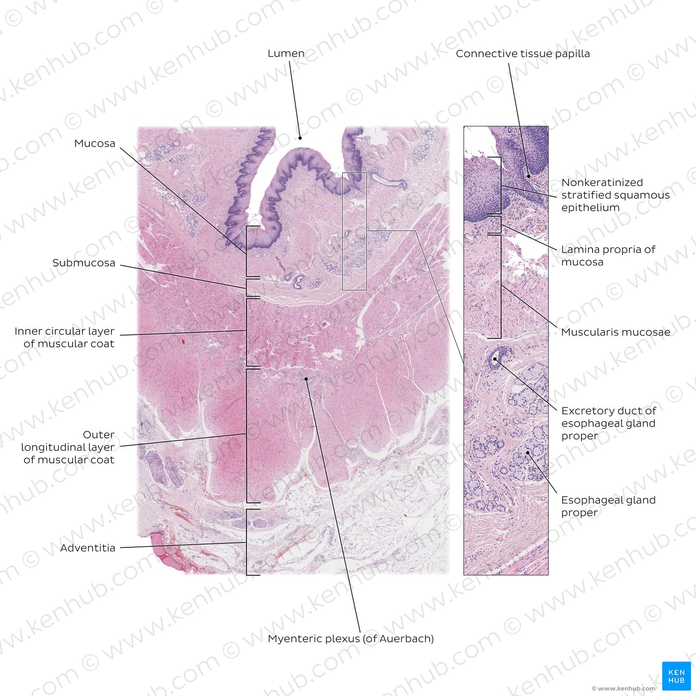 Esophagus in cross section. Stain: H&E. Medium magnification