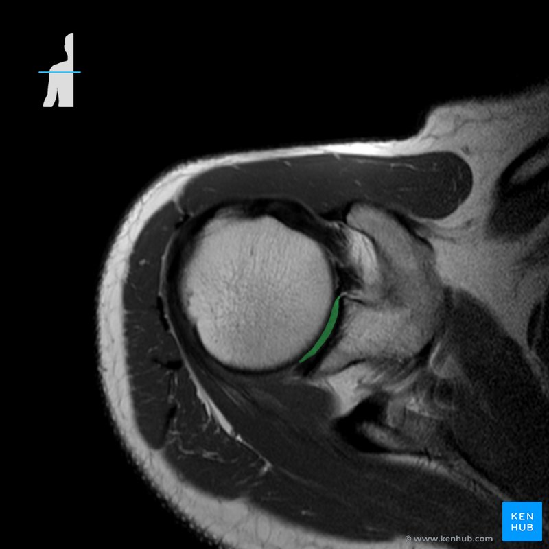 Normal shoulder MRI