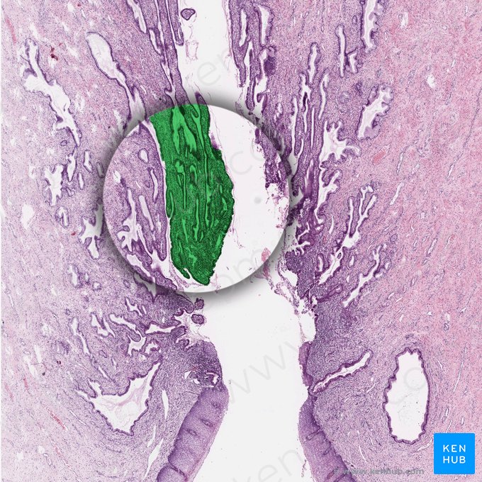 Epitelio columnar simple del endocérvix; Imagen: 