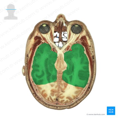 Lóbulo temporal (Lobus temporalis); Imagen: National Library of Medicine