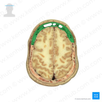 Frontal bone (Os frontale); Image: National Library of Medicine