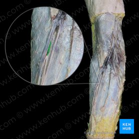 Lateral antebrachial cutaneous nerve (Nervus cutaneus lateralis antebrachii); Image: 
