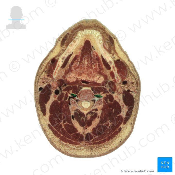 Longus colli muscle (Musculus longus colli); Image: National Library of Medicine