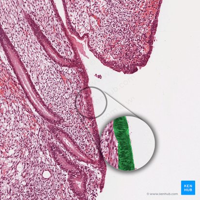 Epitelio cilíndrico simple del endometrio; Imagen: 