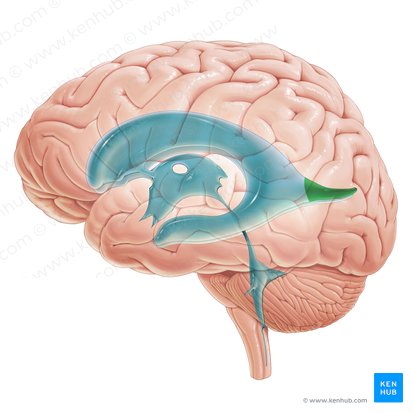 Occipital horn of lateral ventricle (Cornu occipitale ventriculi lateralis); Image: Paul Kim