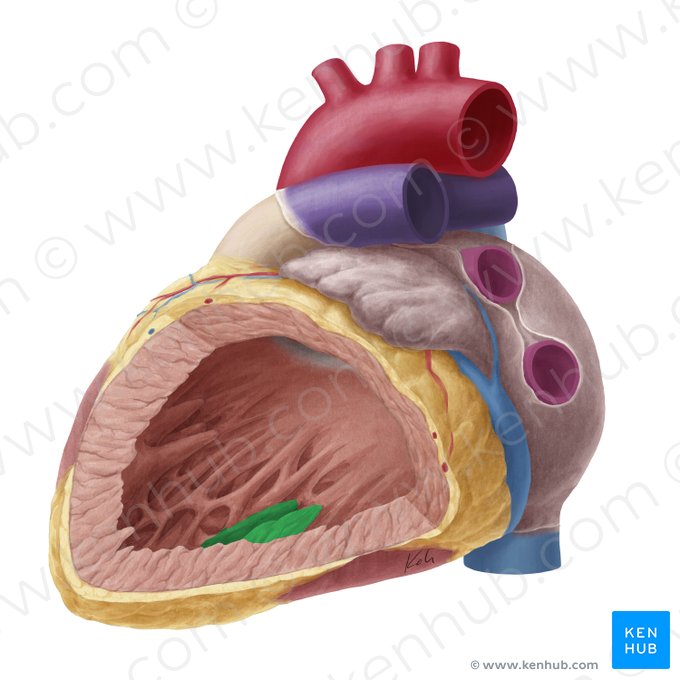 Musculus papillaris inferior ventriculi sinistri (Hinterer Papillarmuskel der linken Herzkammer); Bild: Yousun Koh