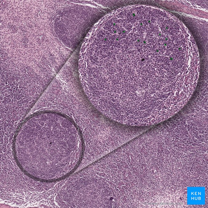 Centroblastus (Zentroblasten); Bild: 