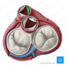 Right semilunar leaflet of pulmonary valve (Valvula semilunaris dextra valvae trunci pulmonalis); Image: Yousun Koh