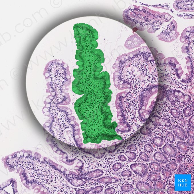 Vellosidad intestinal (Villus intestinalis); Imagen: 