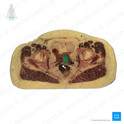 Fundus uteri (Fundus der Gebärmutter); Bild: National Library of Medicine