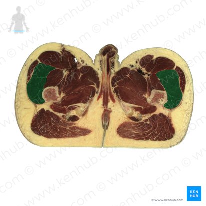 Muscle vaste latéral (Musculus vastus lateralis); Image : National Library of Medicine