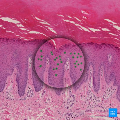 Spinous keratinocyte (Keratinocytus spinosus); Image: 