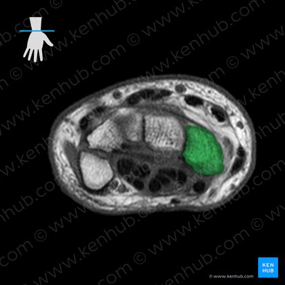 Scaphoid bone (Os scaphoideum); Image: 