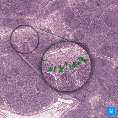 Cordones medulares (Chordae medullares); Imagen: 